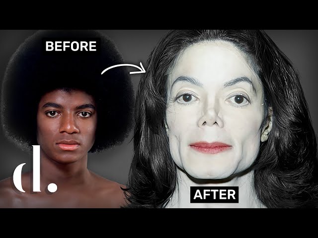 How Much Plastic Surgery Did Michael Jackson Actually Have?!! New Details | The Detail.